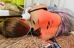Dịch vụ châm cứu tại nhà giúp thư giãn cơ và phục hồi nhanh