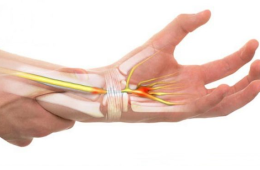 Viêm khớp cổ tay điều trị bằng vật lý trị liệu tại Lâm Đồng
